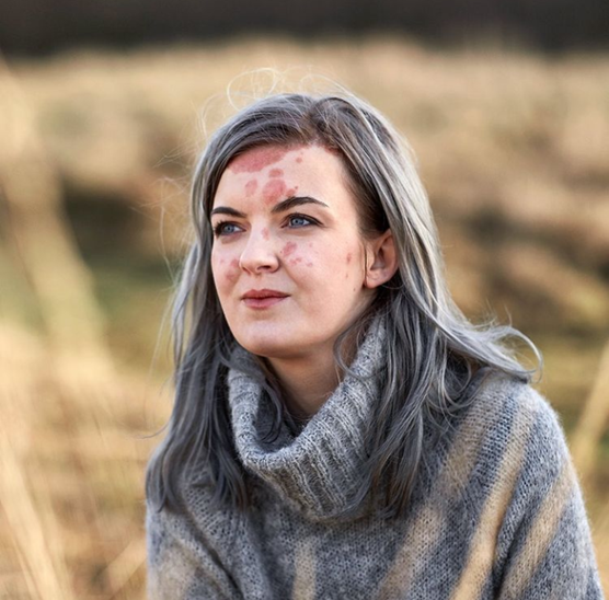 Jude wears a loose fitting turtle neck, and her light brown hair hangs just past her shoulders. She stares into the distance hopefully.