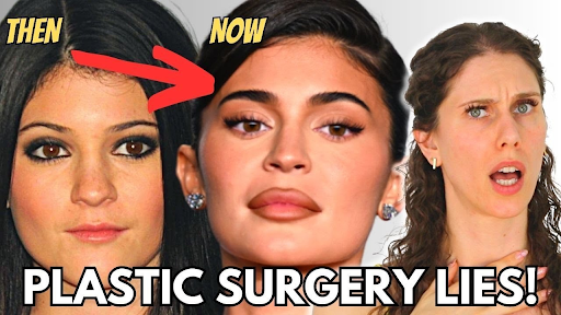 Kylie Jenner Hasn’t Had Plastic Surgery - Here’s how she could be telling the truth.