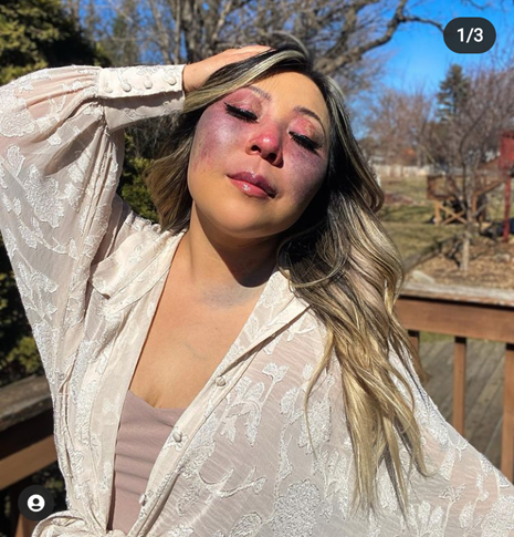 Becca places the palm of her hand on her head and sways to the left. She closes her eyes and appears to be embracing her surroundings. 