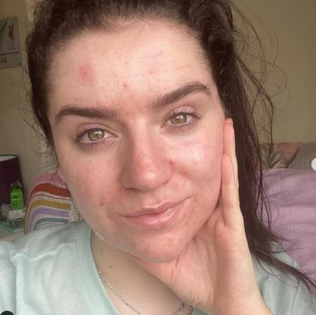 Beth: Making Self-love Accessible