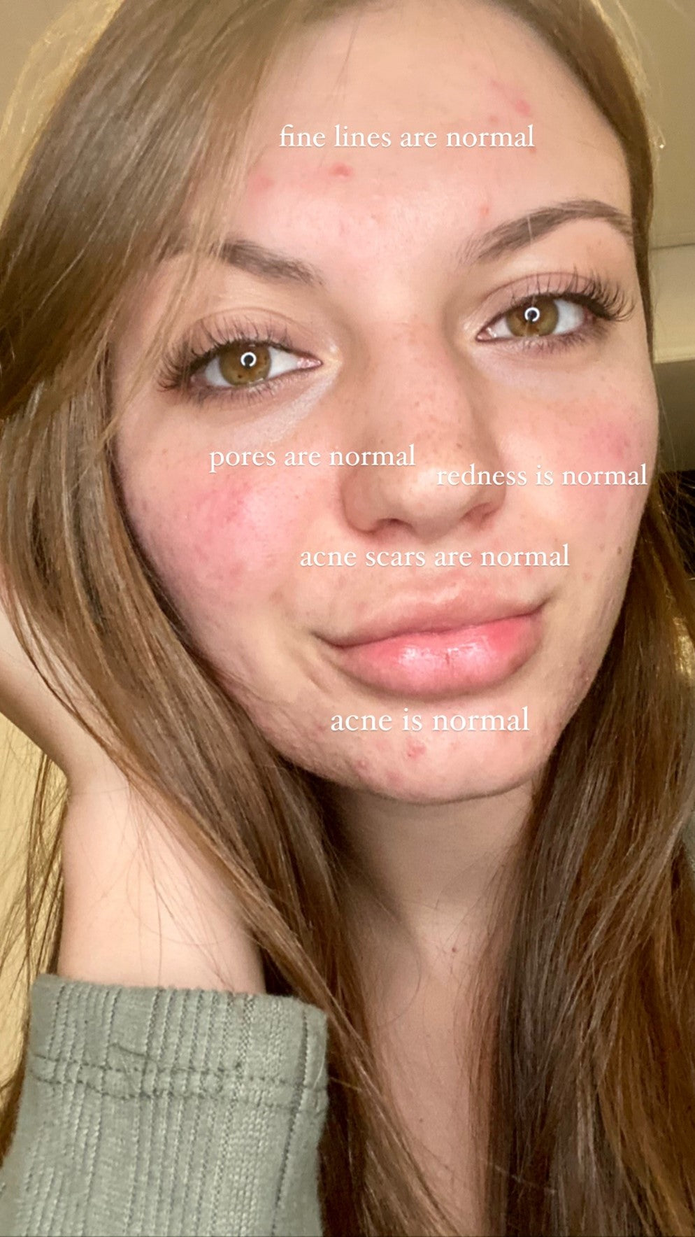 Chelsea smiles unbotheredly. She holds her left to the side of her head.