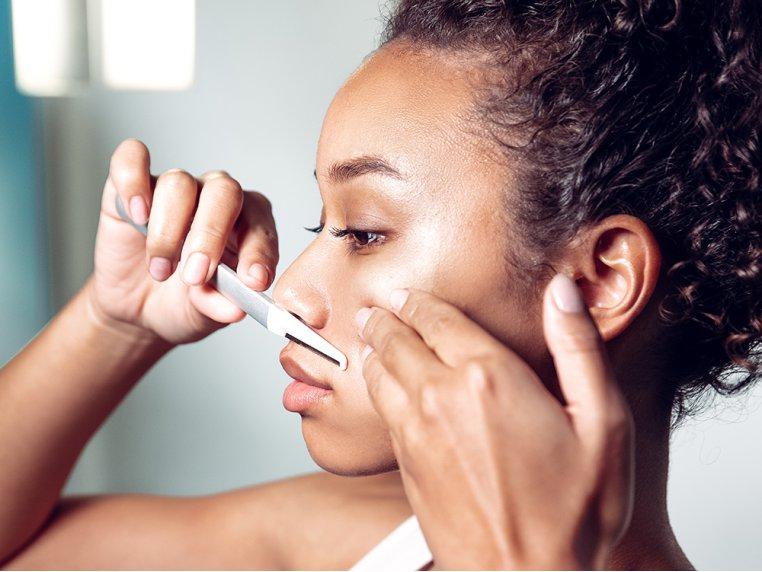 Can Dermaplanning Cause Breakouts?
