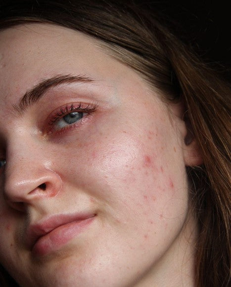 Hanna has fair skin skin, brown hair, and bluish grey eyes. Her head is turned to the left, and she gives a humble but self-assured smile.