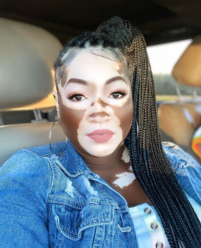 The sunlight is illuminating the different hues of Iomikoe's face. She is wearing very long braids, and they are put into a pony tail on the top of her head, and they fall past her right shoulder.