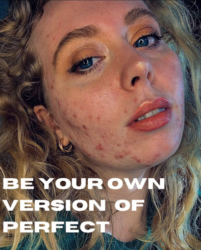 Isabella has fair skin, brown and blonde wavy hair, and blue eyes. The picture reads: be your own version of perfect.