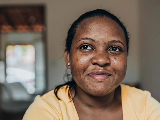 What Are Keloids, and What Are Some Treatment Options?