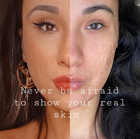 Maya shows a picture of her face. Half is photoshopped the other is natural. It reads: "Never be afraid to show your real skin."