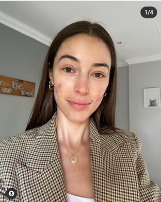 Monique wears a blazer with square print, and her brown hair is parted in the middle. Her hair is tucked neatly behind her eyes, showing small gold hoops. A silver necklace hangs beneath her collar bones in the middle of her chest.