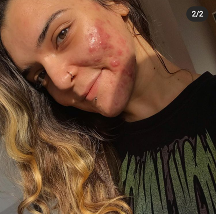 The sunlight shows the light brown colors of Patsy's hair. She has a nose ring, and she gives a warm and familiar smile.