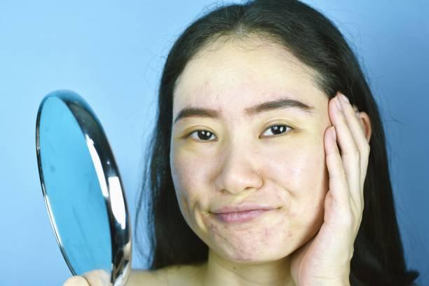 8 Things To Understand about Pores