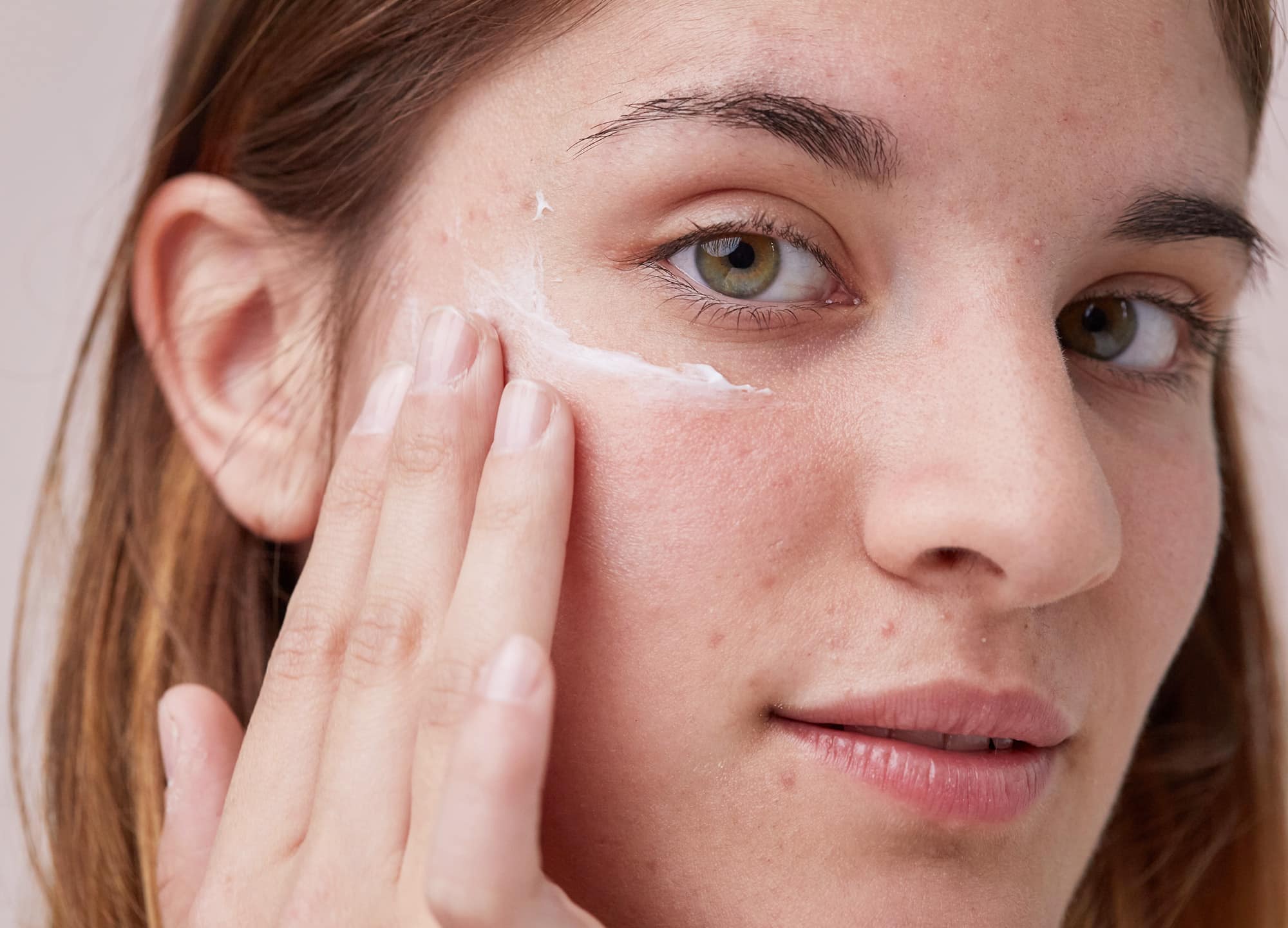 Best Suncreens for Acne-prone Skin of Summer 2022!