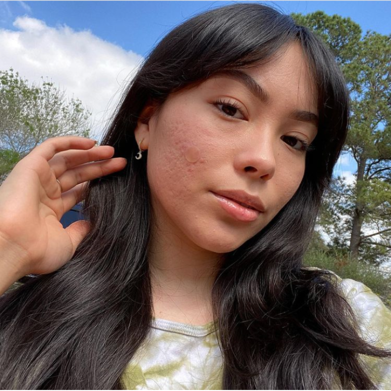 Chelsea has very long and very dark brown hair, almost black. She gently moves her hair out of the way to reveal her skin.