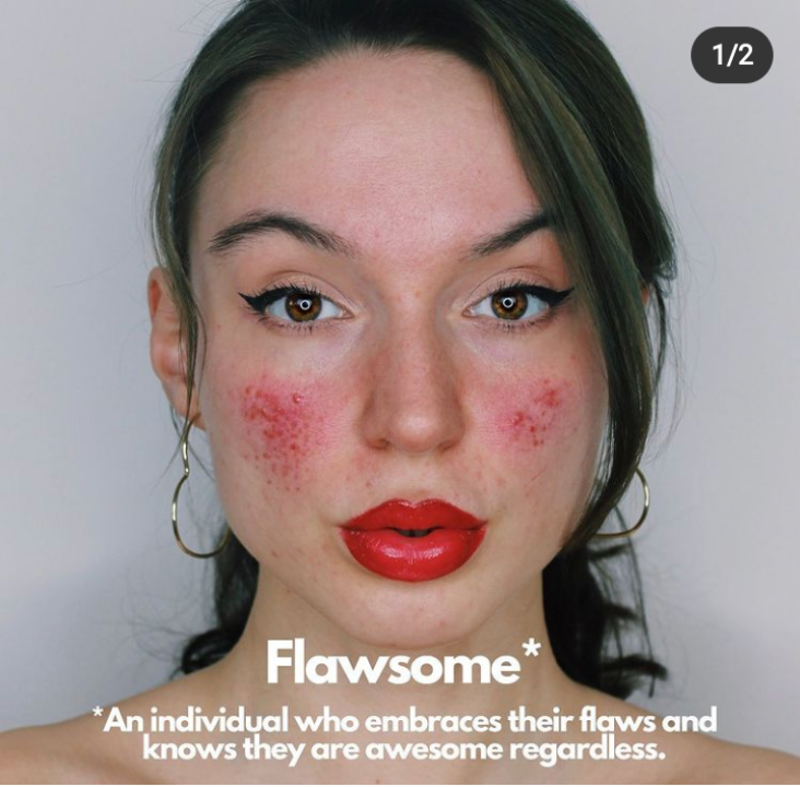 Ahnya wears red lipstick and stares boldly. Her picture reads : flawsome. Being awesome and having flaws at the same time.