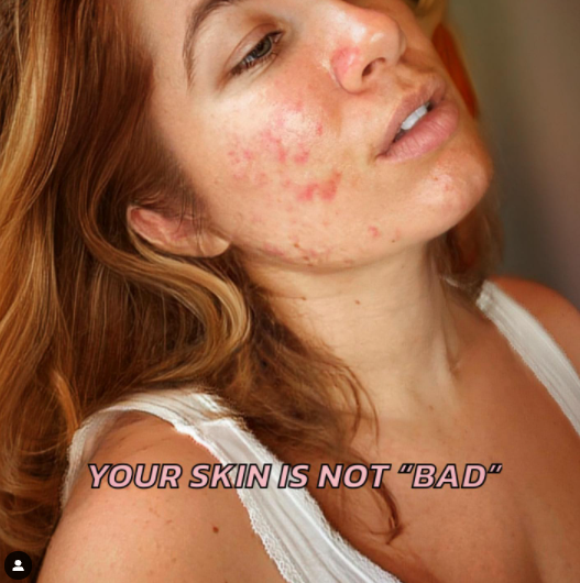 Joanna: Abolishing Beauty Standards from My Mind