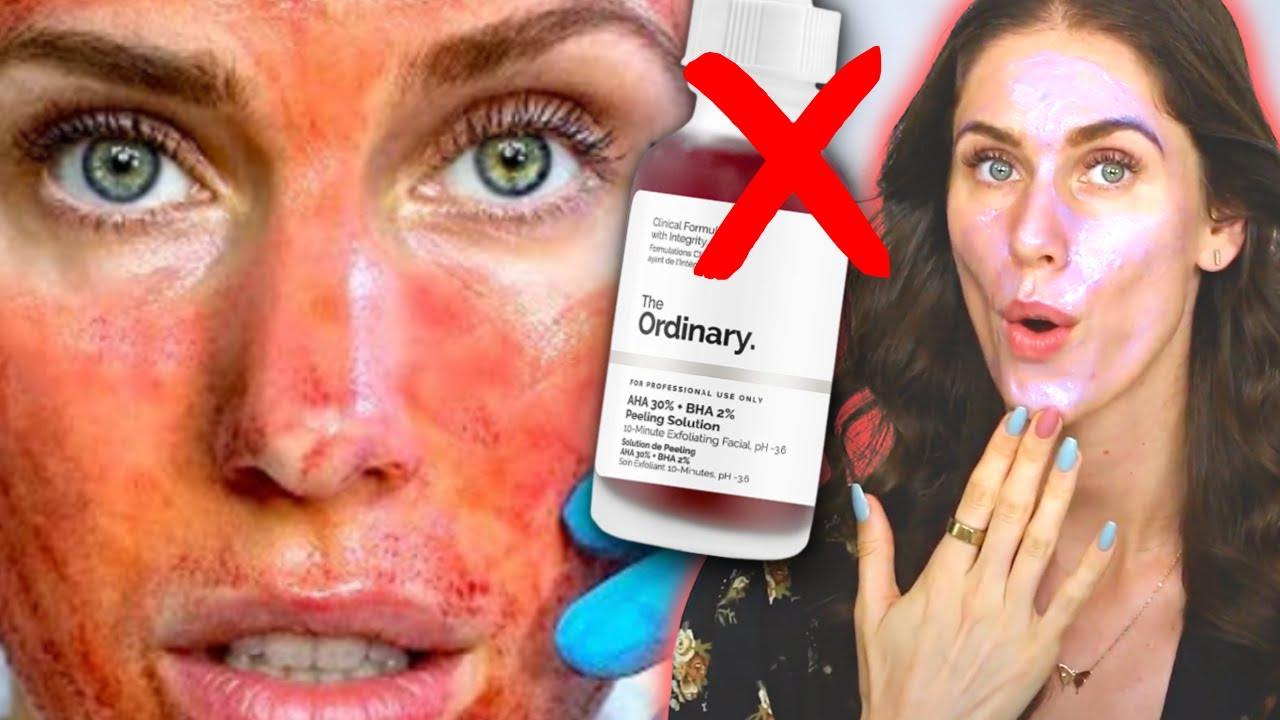 3 Sensitive Skin Swaps for The Ordinary’s 30% AHA + 2% BHA Peel