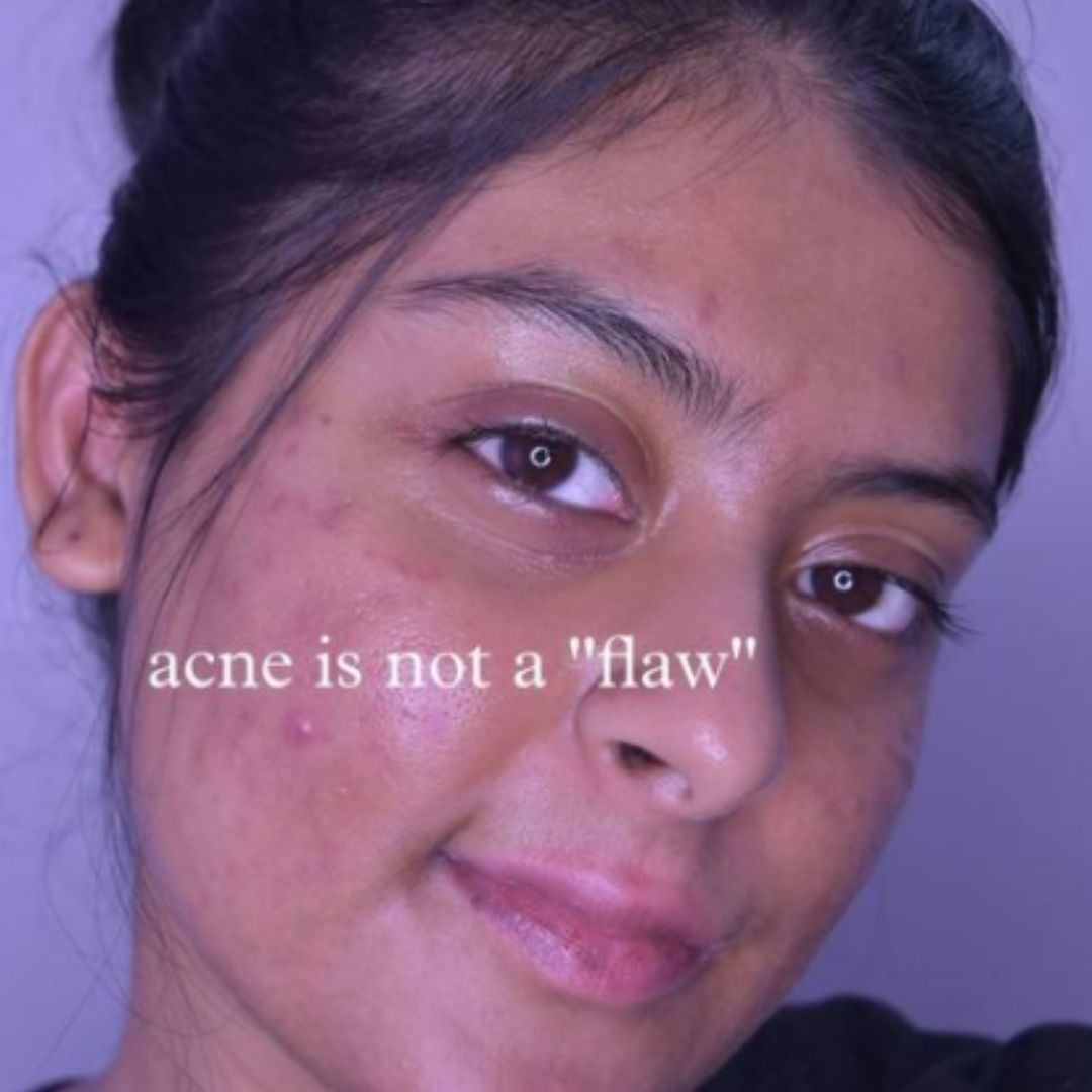 Ishita: Living Beyond Our Skin