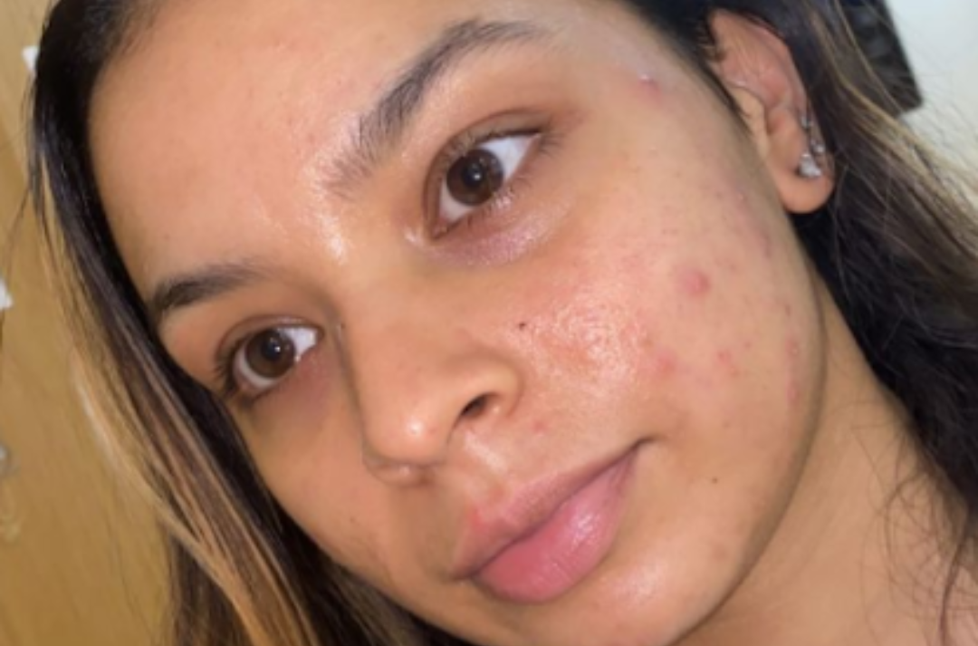 Kiara: Learning to Believe in Self-Love