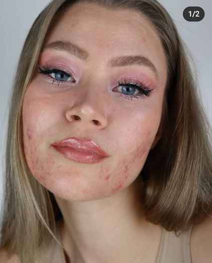 Yoella has brown and blonder hair. She has blue eyes, and her eye brows are done well. She tilts her head to the right and smiles in a carefree manner.