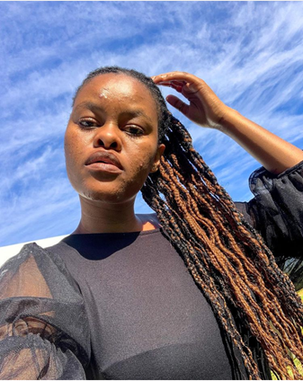 The blue sky is behind Zinhle with wispy clouds. She has long light brown and dark brown braids. She places the tips of her fingers on her head and has looks at us contemplatively.
