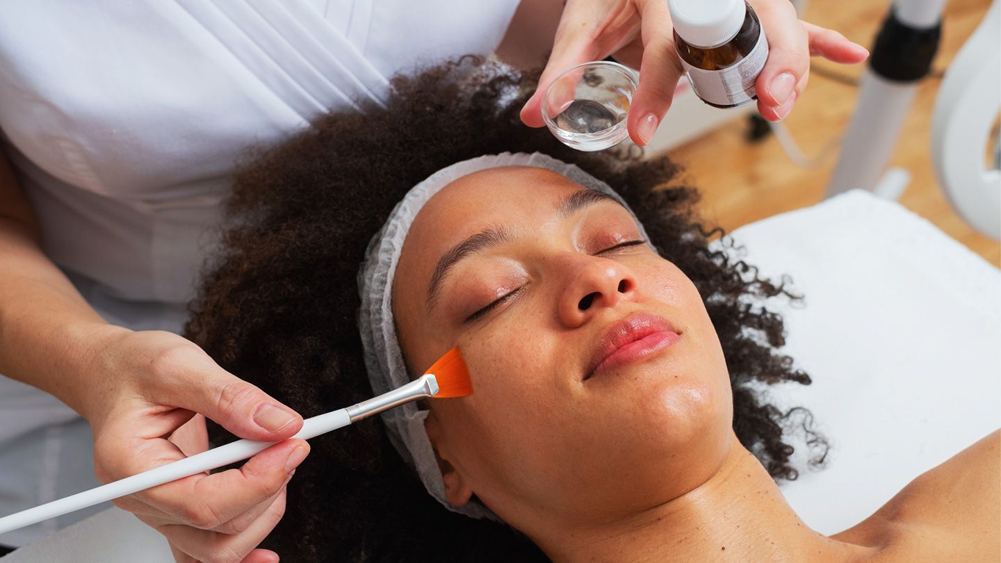 Here Are 3 Surprising Things Chemical Peels Do to Your Skin over Time