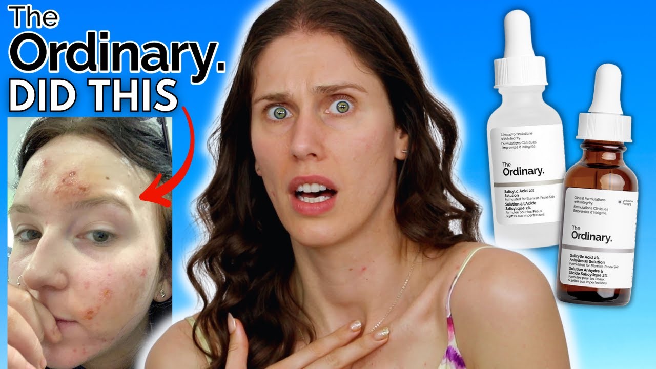 The Ordinary’s Relaunch: The Salicylic Acid Solution vs The Salicylic Acid Anhydrous Solution?