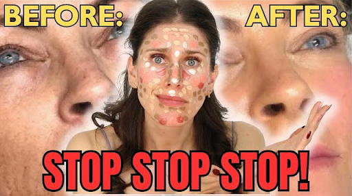 The Hidden Risks Of The $400 BB Glow Microneedling Makeup Facial