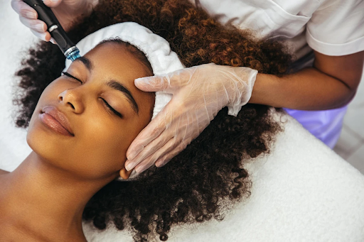 How Does Microneedling Work? Wound Healing and Collagen Synthesis
