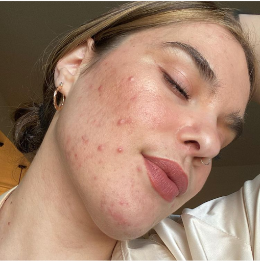 Sabrina has fair skin, and she is tilting her head to the right into her shoulder whimsically. Her eyes are closed, and she is smiling gently as if she's having a comforting and pleasant dream.