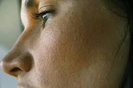 Are Pore Vacuums Safe?