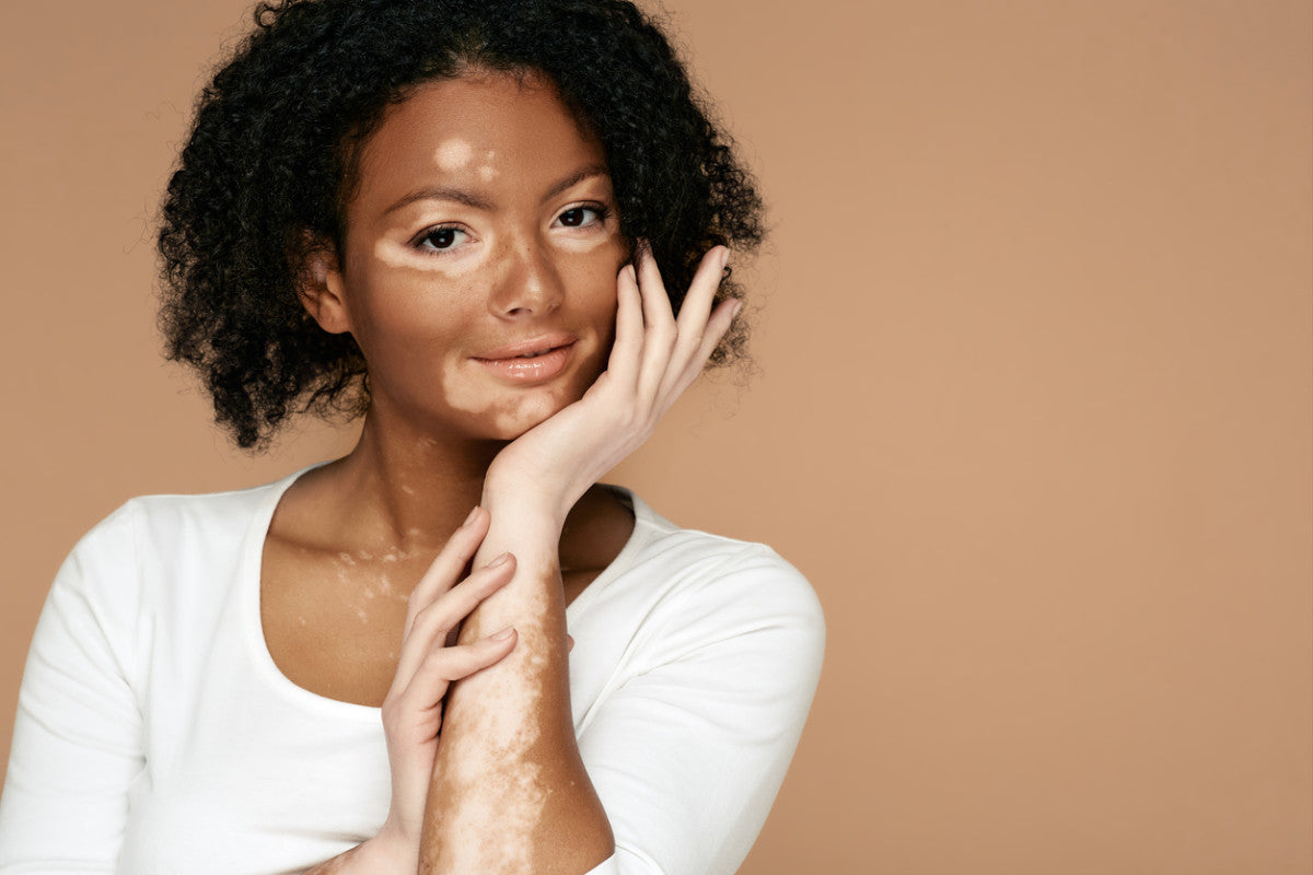 Why Are My Nails Brittle? 5 Things That Might Be Causing It